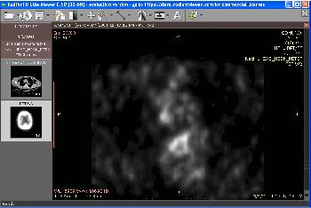 radiant dicom viewer 4.2.1 crack